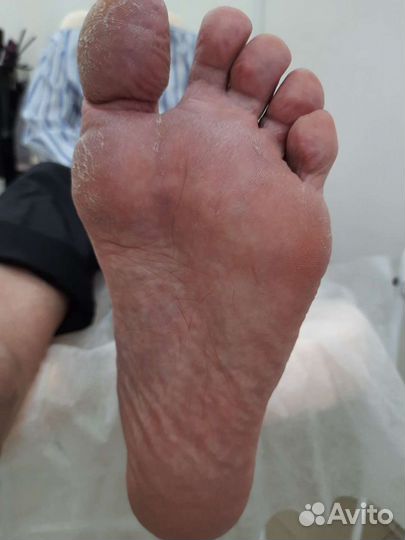 Для мужчин и женщин - гигиенический педикюр