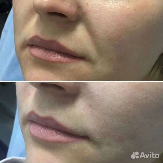 Услуги косметолога