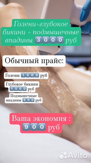 Лазерная эпиляция