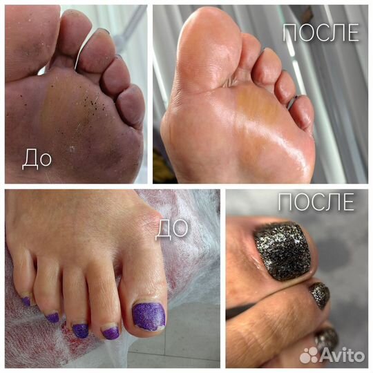 Мастер педикюра