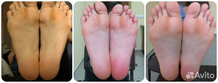 Педикюрные носочки