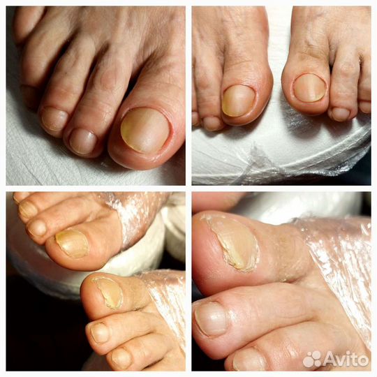 Мастер педикюра