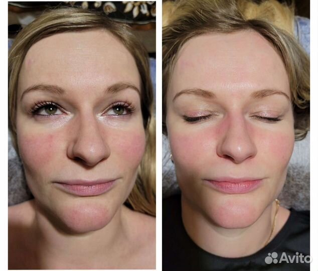 Массаж, кавитация, RF лифтинг, вакуум, вибромассаж