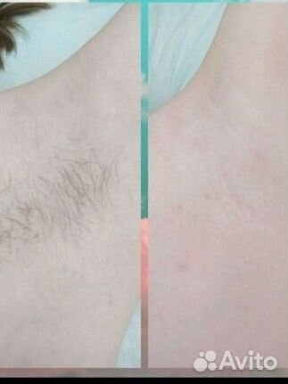 Шугаринг (только женский)