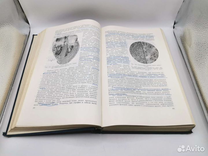 Книга Паталогическая Анатомия 1961 год