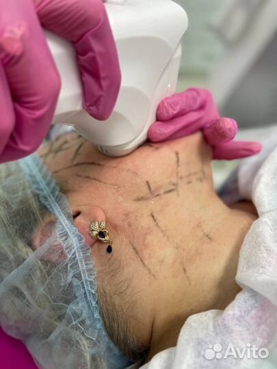 Косметологическое оборудование для бизнеса