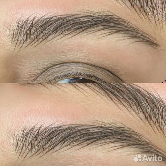Гиперестественные брови Аппаратные волоски