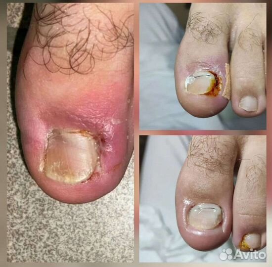 Подолог, Медицинский педикюр, Услуги подолога