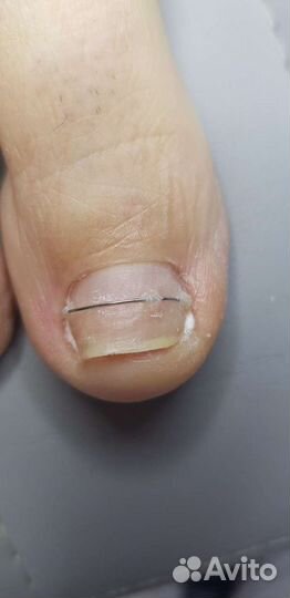 Услуги подолога