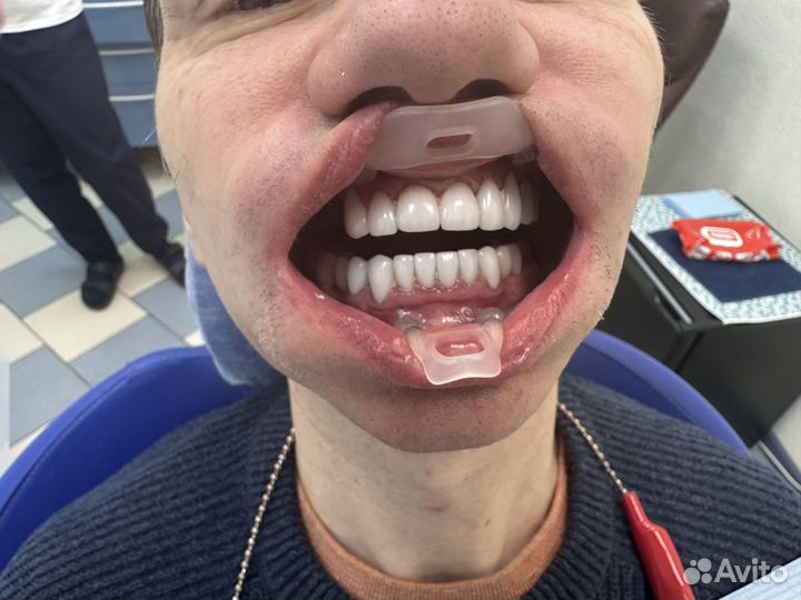 Стоматолог хирург имплантолог