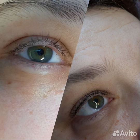 Ламинирование ресниц