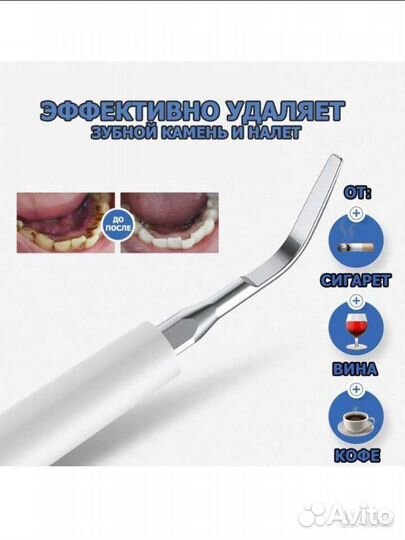 Ультразвуковой скалер
