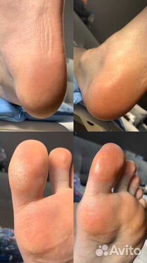 Наращивание ногтей