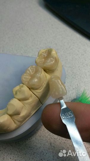 Зубной техник