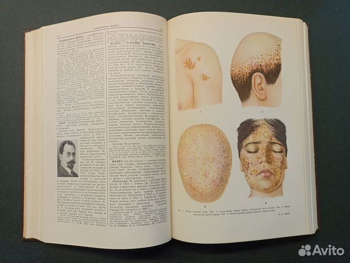 Большая медицинская энциклопедия. Том 33. 1963 