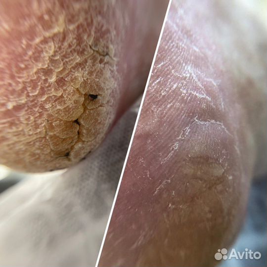 Услуги подолога