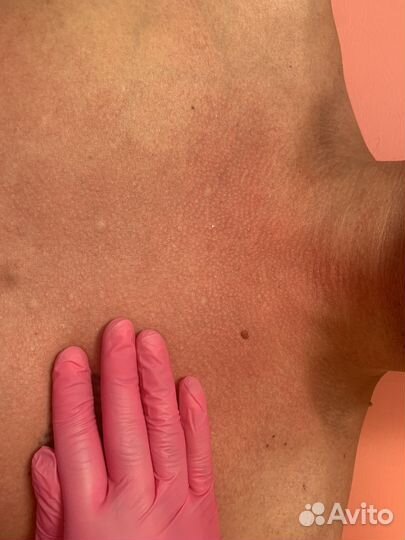 Шугаринг депиляция