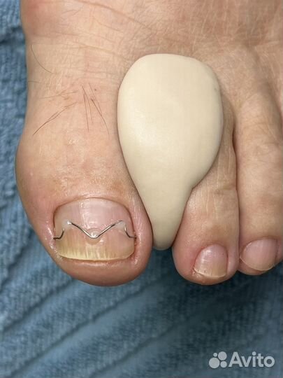 Услуги подолога