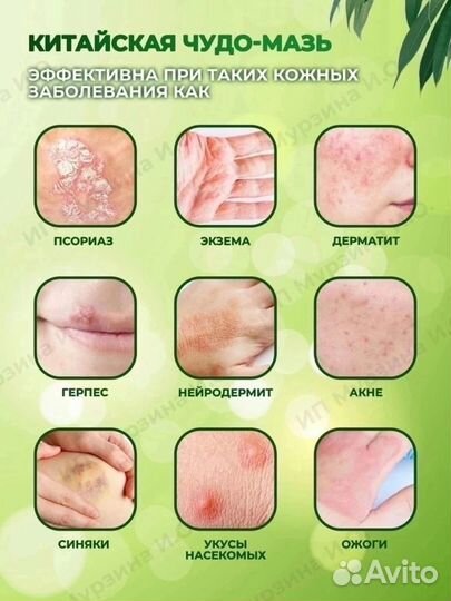 Китайская чудо мазь Fule Wang (при псориазе, экзем