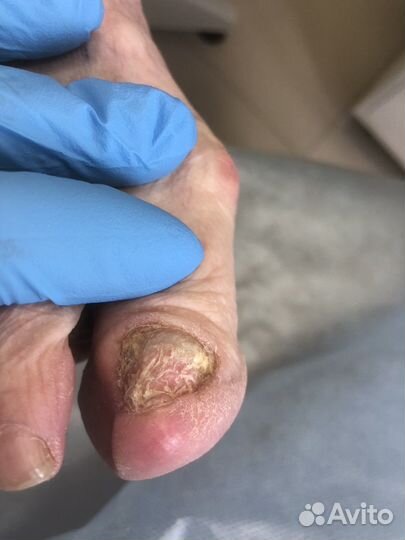 Подология, педикюр, маникюр