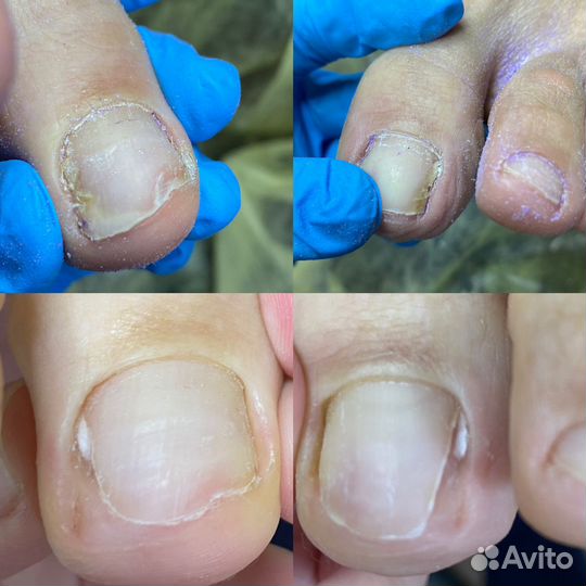 Подолог, педикюр