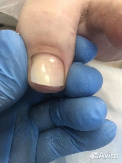 Подология, педикюр, маникюр