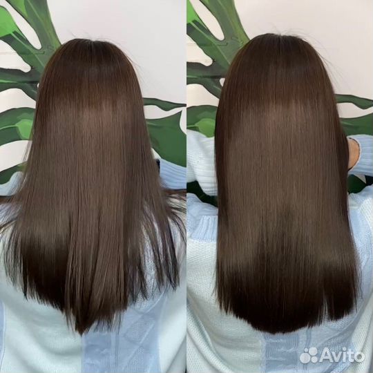 Ботокс, биксипластия,пилинг кожи. Провожу обучение