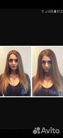 Прикорневой объем 3D Volume