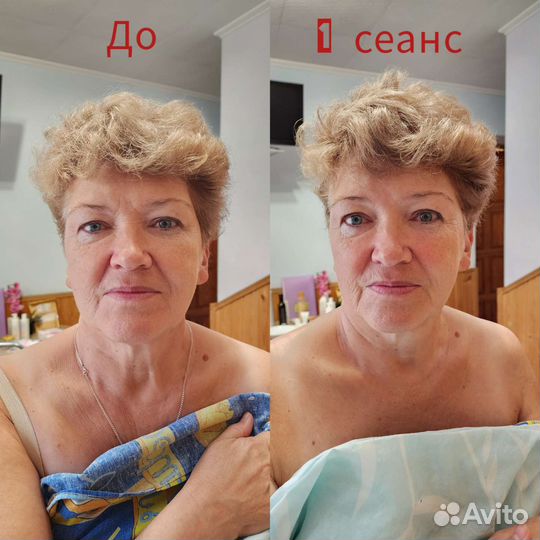 Скульптурный массаж лица