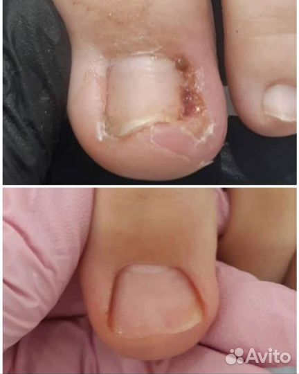 Подолог студия подологии выезд на дом