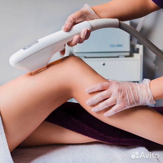 Лазерная эпиляция