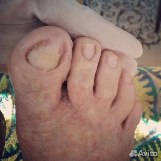 Педикюр(подолог)