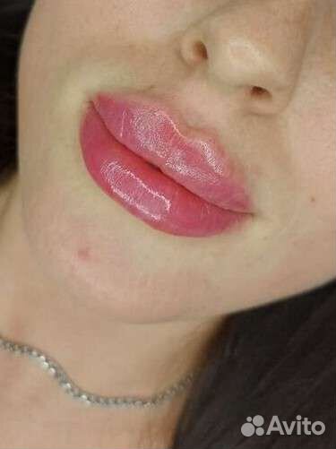 Увеличение губ косметология ботокс
