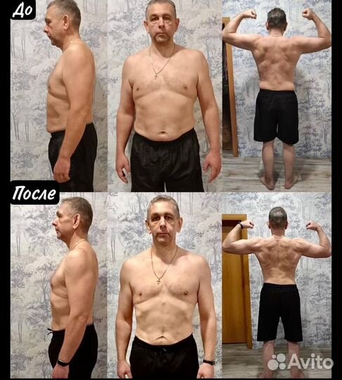 Сжигание жира без боли и операций. Ультразвуковое