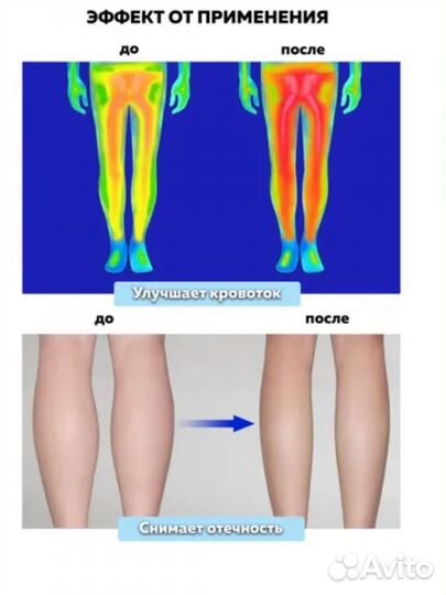 Компрессионный лимфодренажный массажер MFC-50