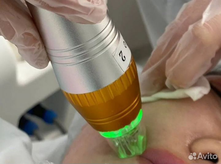 Аппарат для RF лифтинга