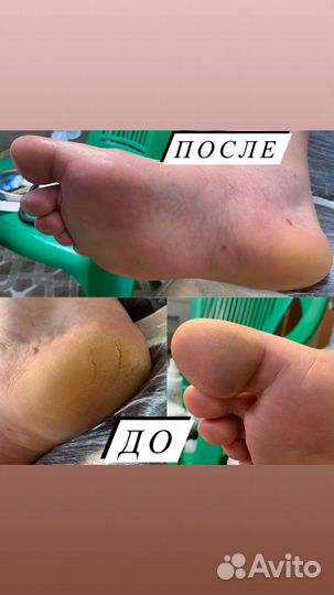 Педикюр и маникюр