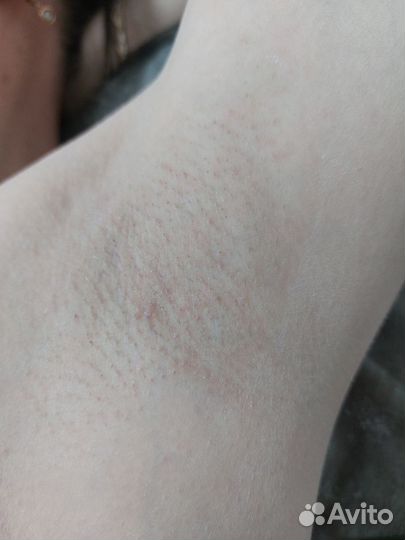 Ищу моделей на восковую депиляцию