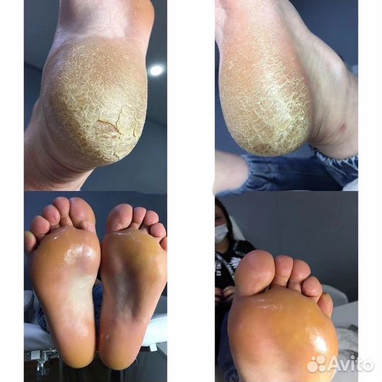 Smart педикюр