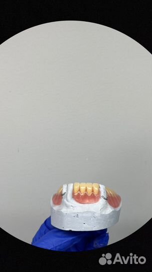 Зубные протезы