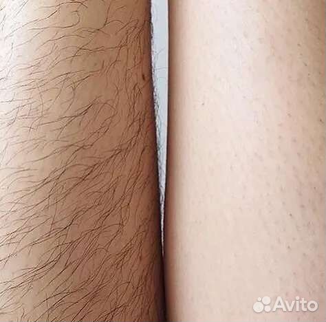 Шугаринг, Ваксинг