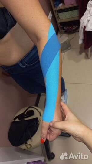 Тейпирование