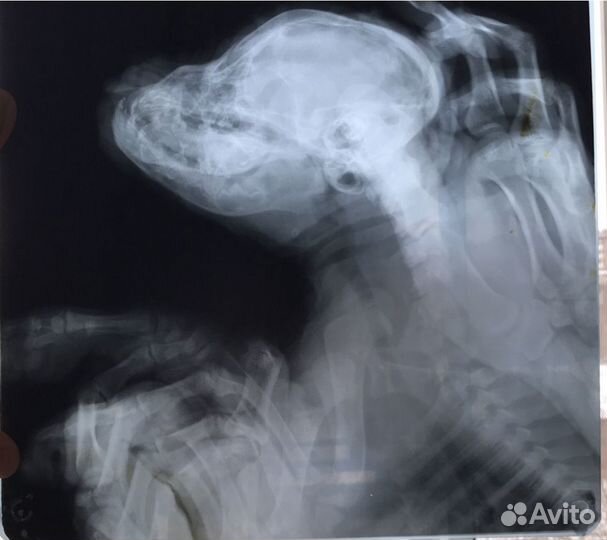 Рентгеновский снимок