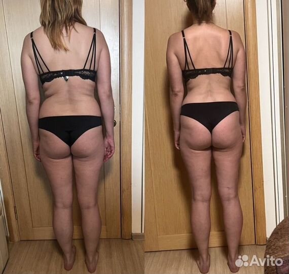 Массаж. LPG массаж.Выезд на дом