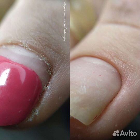 Smart педикюр 