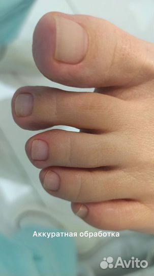 Подолог Педикюр